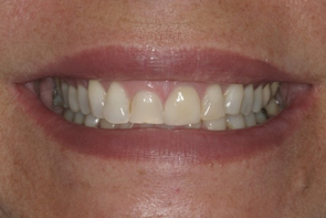 Aesthetic Dentistry, Cosmetic Dentistry