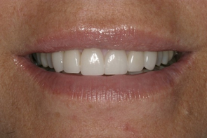 Aesthetic Dentistry, Cosmetic Dentistry