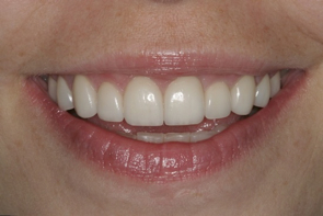 Aesthetic Dentistry, Cosmetic Dentistry